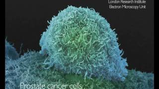 What Does Cancer Look Like  Cancer Research UK [upl. by Sadler241]