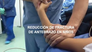 FRACTURA DE ANTEBRAZO EN EL NIÑO TRATAMIENTO QUIRURGICO [upl. by Artie]