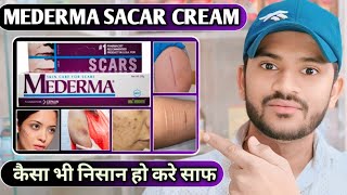 Medrma scar cream use dose benefits and side effects full review hindi [upl. by Leff674]