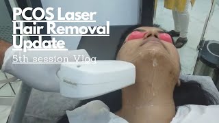 Laser hair removal face before and after 5th session  Hair growth and Laser burn update [upl. by Billie633]