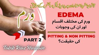 Edema lecture in Urdu Hindi P2  Types of Edema  Generalized Edema  Pitting amp non pitting edema [upl. by Immak]