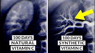 We Finally Know What Type Of Vitamin C Is Best [upl. by Nylhtac481]