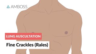 Fine Crackles Rales  Lung Auscultation  Episode 2 [upl. by Pack]