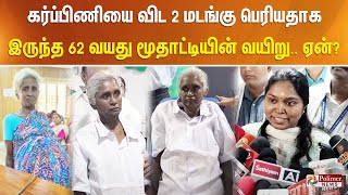 கர்ப்பிணியை விட 2 மடங்கு பெரியதாக இருந்த 62 வயது மூதாட்டியின் வயிறு ஏன் [upl. by Neffirg918]