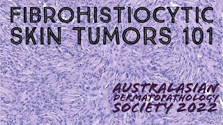 Fibrohistiocytic Skin Tumors 101 Australasian Dermatopathology Society 2022 meeting pathology [upl. by Astrid926]