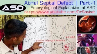 Atrial Septal Defect ASD  Part 1  Embryology Explained  Dr Saykat [upl. by Elwina]