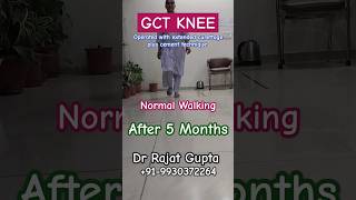 bonetumour GCT knee  treated with extended curettagecementing technique Dr Rajat Gupta [upl. by Regdor]