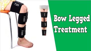 Bow Legged Treatment Knock Knees In Adults Exercises To Straighten Bow Legs Bow Legged Correction [upl. by Rednave]