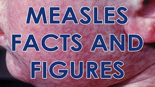 Measles and the MMR Vaccine Facts and Figures [upl. by Nollahp]