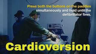 cardioversion How to give Shock with defibrillator and why [upl. by Kally]