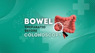 Essential Guide Preparing for Your Colonoscopy [upl. by Case]