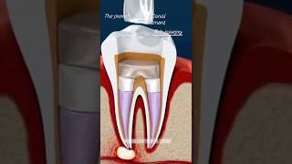 ROOT CANAL TREATMENT [upl. by Aikemaj]