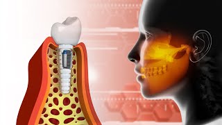 Elimina Toxinas El Cuerpo Cura Tu Cuerpo Forma Permanente Liberación Enzyme Melatonina Y Toxina [upl. by Aryhs]