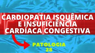 CARDIOPATIA ISQUÊMICA E INSUFICIÊNCIA CARDÍACA CONGESTIVA  PATOLOGIA 28 [upl. by Brownley83]