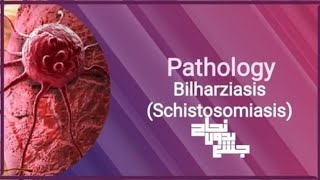 Bilharziasis  schistosomasis patho L10 [upl. by Gabrila]