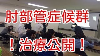 肘部管症候群【治療法公開！治療者さん向け動画】 [upl. by Narrat723]