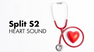 Fixed Split S2  Heart Sounds  MEDZCOOL [upl. by Kath]