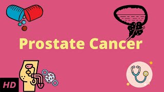 Prostrate Cancer Causes Signs and Symptoms DIagnosis and Treatment [upl. by Innattirb]