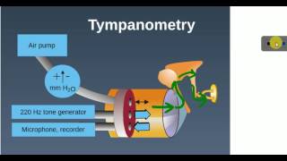 ENT LECTURES  Investigations  TYMPANOMETRY [upl. by Anaihr]