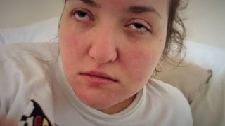 Absence Seizure after an Eyelid Myoclonia Jeavons Syndrome in Status Epilepticus  Shiatsu help [upl. by Ail606]