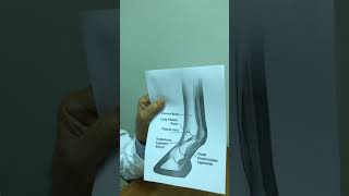 مفصل المعقم في الخيل affection of fetlock joint in horse [upl. by Ahsiekar817]