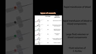 TYPES OF CANNULA cannulation cannula types hospitality nurseryrhymes [upl. by Jyoti]