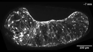 ZEISS ApoTome Tribolium extraembryonic tissue rupture and withdrawal [upl. by Vedetta]