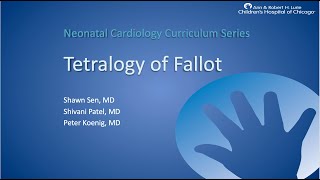 Tetralogy of Fallot [upl. by Halona]