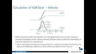 ICS Impulse vHIT Interpretation of test results [upl. by Kerrin550]