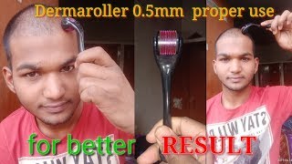 How to use derma roller system 05mm proper for better result।Sonu Kumar Mishra। dermarollersystem [upl. by Berkeley]