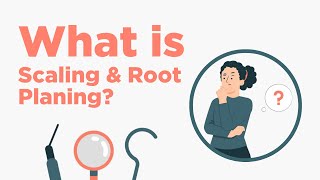 Scaling amp Root Planing  Everything You Need to Know [upl. by Ahsitel907]