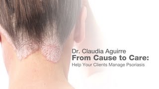 From Cause to Care Help your clients manage psoriasis [upl. by Nnylarej]