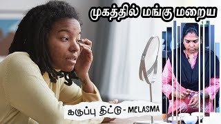 முகத்தில் உள்ள மங்கு மறைய  Home Remedies for Melasma HyperPigmentation  Mangu Maraiya Tips [upl. by Narba63]