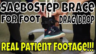 SaeboStep Brace for Foot DragDrop  REAL Patient Footage [upl. by Elram]