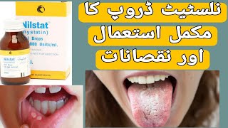 Nilstat Drops Uses  Nilstat Drops Side Effects  Mouth ulcer  Nystatin Uses in UrduHindi [upl. by Duester734]