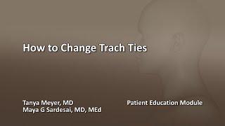 How to Change Trach Ties [upl. by Grof388]