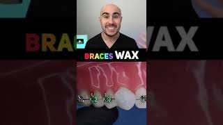 Braces Wax [upl. by Nakada]