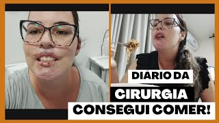 Cortou a língua consegui comer um pouco procedimentos [upl. by Enert]