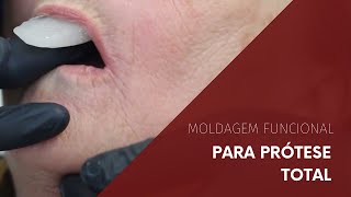 Moldagem Funcional para Prótese Total [upl. by Annaiv664]