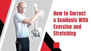 How to Correct a Scoliosis With Exercise and Stretching  Ed Paget [upl. by Airec]