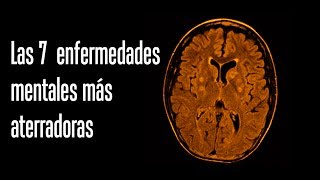 Las 7 enfermedades mentales más aterradoras [upl. by Sethrida]