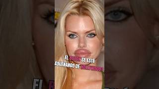 El Botox en Hollywood ¡Expresiones Perdidas shortsfeed hollywood Botox nicolekidman [upl. by Ateloj]