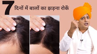 बालों का झड़ना जड़ से खत्म करें Stop Hair Fall from Root  Sanyasi Ayurveda [upl. by Anirba125]