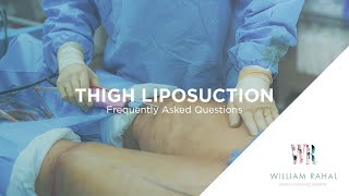 Thigh Liposuction Recovery amp other FAQs Frequently Asked Questions [upl. by Deehahs347]