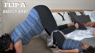 HOW TO FLIP BREECH BABY  YANELY AMADIZ [upl. by Turmel279]