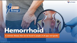 Hemorrhoid a common disease that can be found in people of all ages and gender  Vejthanis Scoop [upl. by Ravo]