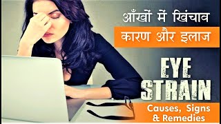 Eye Strain Causes Signs amp Treatment  Easy Tips to cure Eye strain आँखों में खिंचाव  कारण और इलाज [upl. by Iseabal]