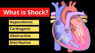 Shock Explained in 120 Seconds  Treatment Symptoms Causes  Video [upl. by Ahs]