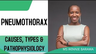 PNEUMOTHORAX TYPES  TENSION OPEN CLOSED PNEUMOTHORAX PATHOPHYSIOLOGY CAUSES [upl. by Ayoted28]