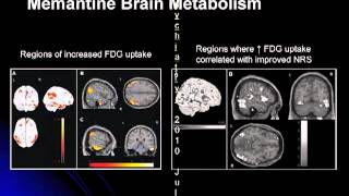 Treatment of Dementia [upl. by Atival]